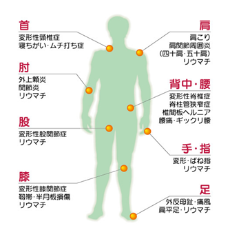 運動療法イラスト